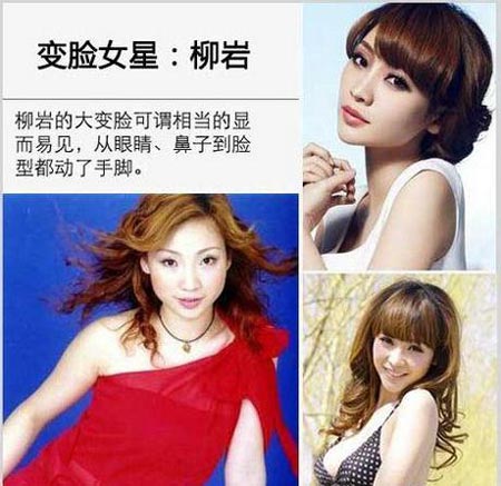 柳岩整容前后对比照
