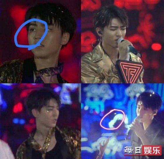 TFBOYS激光笔是什么梗 遭遇过激光笔的明星都有谁?