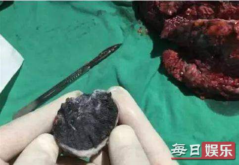 袁立否认私吞善款说了什么 袁立私吞善款是真的吗?